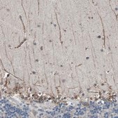 Anti-CLCC1 antibody produced in rabbit Ab1, Prestige Antibodies&#174; Powered by Atlas Antibodies, affinity isolated antibody, buffered aqueous glycerol solution