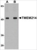 Anti-TMEM214 antibody produced in rabbit affinity isolated antibody, buffered aqueous solution, ab2
