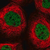 Anti-OTUD6B antibody produced in rabbit Prestige Antibodies&#174; Powered by Atlas Antibodies, affinity isolated antibody, buffered aqueous glycerol solution, Ab1