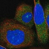 Anti-ABTB1 antibody produced in rabbit Prestige Antibodies&#174; Powered by Atlas Antibodies, affinity isolated antibody, buffered aqueous glycerol solution