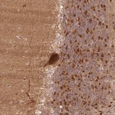 Anti-XPR1 antibody produced in rabbit Prestige Antibodies&#174; Powered by Atlas Antibodies, affinity isolated antibody, buffered aqueous glycerol solution