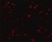 Anti-CCL17 antibody produced in rabbit affinity isolated antibody, buffered aqueous solution