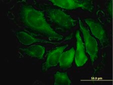 Monoclonal Anti-PAK1 antibody produced in mouse clone 4D1, purified immunoglobulin, buffered aqueous solution