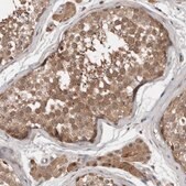 Anti-CHML antibody produced in rabbit Prestige Antibodies&#174; Powered by Atlas Antibodies, affinity isolated antibody, buffered aqueous glycerol solution