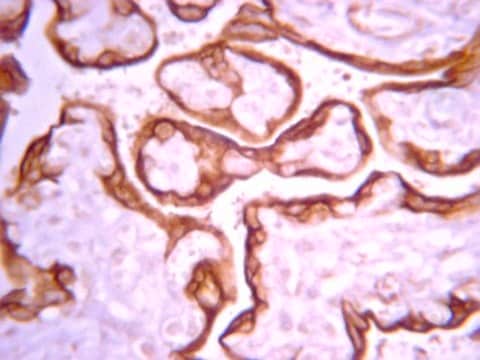 Anti-IGF-IR Antibody, &#946;-subunit, clone 1-2 clone 1-2, from mouse, purified by affinity chromatography