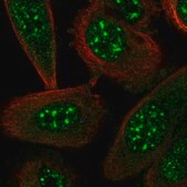 Anti-STYXL1 antibody produced in rabbit Prestige Antibodies® Powered by Atlas Antibodies, affinity isolated antibody, buffered aqueous glycerol solution