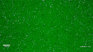 Assay Ready LX-2 Human Hepatic Stellate Cell Line