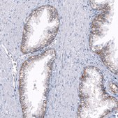 Monoclonal Anti-TRPM4 antibody produced in mouse Prestige Antibodies® Powered by Atlas Antibodies, clone CL11214, purified antibody (Protein A)