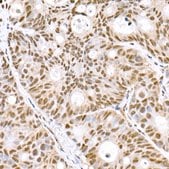 Anti-Prdm9 Antibody, clone 1H9Z1, Rabbit Monoclonal