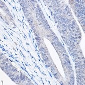Anti- Bax antibody produced in rabbit