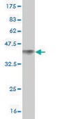 Monoclonal Anti-DVL3 antibody produced in mouse clone 4H2, purified immunoglobulin, buffered aqueous solution