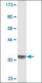 Monoclonal Anti-PRELID1 antibody produced in mouse clone 6G1, purified immunoglobulin, buffered aqueous solution