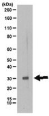 Anti-TIGAR Antibody from rabbit, purified by affinity chromatography