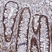 Anti-RNASEH2B antibody produced in rabbit Prestige Antibodies® Powered by Atlas Antibodies, affinity isolated antibody, buffered aqueous glycerol solution