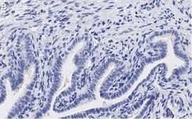 Anti-PKC&#953; Antibody, clone 1J13 ZooMAb&#174; Rabbit Monoclonal recombinant, expressed in HEK 293 cells