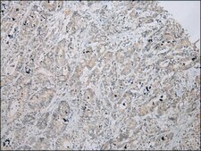 Anti-ZNF621 affinity isolated antibody