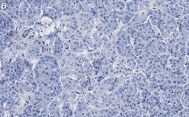 Anti-CNKSR1 Antibody, clone 4B7 ZooMAb® Rabbit Monoclonal recombinant, expressed in HEK 293 cells