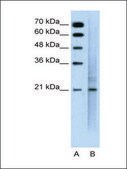 Anti-MUC1 affinity isolated antibody