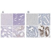 Anti-DAZL antibody produced in rabbit Prestige Antibodies® Powered by Atlas Antibodies, affinity isolated antibody, buffered aqueous glycerol solution, Ab1