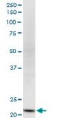Monoclonal Anti-NDUFV2, (C-terminal) antibody produced in mouse clone 1A10, purified immunoglobulin, buffered aqueous solution
