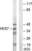 Anti-HEXIM1 antibody produced in rabbit affinity isolated antibody