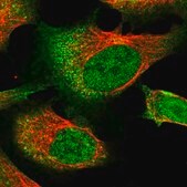 Anti-RNF111 antibody produced in rabbit Prestige Antibodies® Powered by Atlas Antibodies, affinity isolated antibody, buffered aqueous glycerol solution