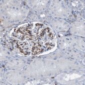 Anti-RNF182 antibody produced in rabbit Prestige Antibodies&#174; Powered by Atlas Antibodies, affinity isolated antibody, buffered aqueous glycerol solution