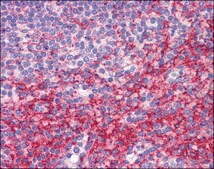 Anti-ATG9B / APG9L2 antibody produced in rabbit affinity isolated antibody