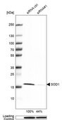 抗-SOD1 兔抗 Prestige Antibodies&#174; Powered by Atlas Antibodies, affinity isolated antibody, buffered aqueous glycerol solution