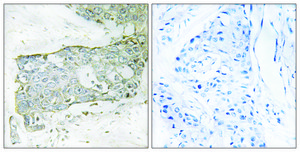 Anti-FA7 (light chain, Cleaved-Arg212) antibody produced in rabbit affinity isolated antibody