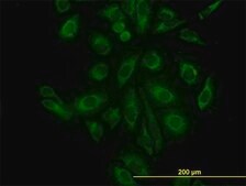 Monoclonal Anti-ACTR3 antibody produced in mouse clone 2B6, purified immunoglobulin, buffered aqueous solution