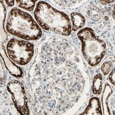 Anti-CPT1A antibody produced in rabbit Prestige Antibodies® Powered by Atlas Antibodies, affinity isolated antibody, buffered aqueous glycerol solution