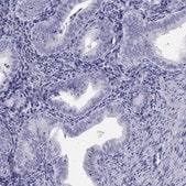 Anti-ALOX15B antibody produced in rabbit Prestige Antibodies&#174; Powered by Atlas Antibodies, affinity isolated antibody
