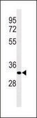 ANTI-AIG1 (N-TERM) antibody produced in rabbit IgG fraction of antiserum, buffered aqueous solution