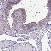 Anti-KCNMA1 antibody produced in rabbit Prestige Antibodies&#174; Powered by Atlas Antibodies, affinity isolated antibody, buffered aqueous glycerol solution