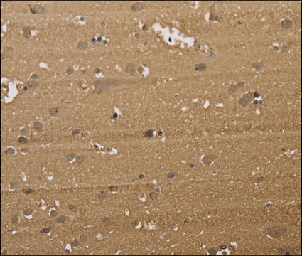 Anti-KDM5B antibody produced in rabbit affinity isolated antibody