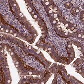 Anti-MVP antibody produced in rabbit Prestige Antibodies&#174; Powered by Atlas Antibodies, affinity isolated antibody