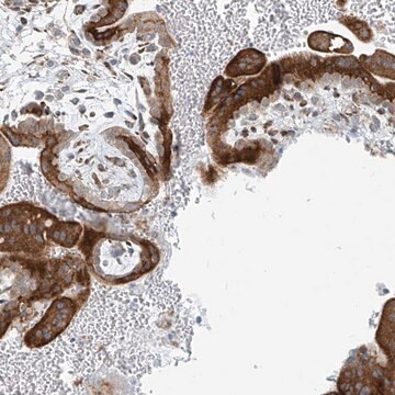 Anti-HIC2 antibody produced in rabbit Prestige Antibodies&#174; Powered by Atlas Antibodies, affinity isolated antibody, buffered aqueous glycerol solution
