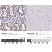Anti-TMED10 antibody produced in rabbit Prestige Antibodies® Powered by Atlas Antibodies, affinity isolated antibody, buffered aqueous glycerol solution