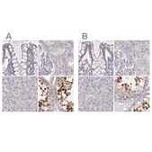 Anti-PBK antibody produced in rabbit Prestige Antibodies® Powered by Atlas Antibodies, affinity isolated antibody