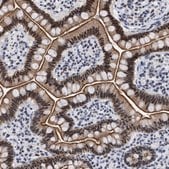 Anti-DDX41 antibody produced in rabbit Prestige Antibodies&#174; Powered by Atlas Antibodies, affinity isolated antibody, buffered aqueous glycerol solution