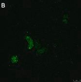 Anti-ATG8 Antibody, clone 2B11 ZooMAb&#174; Rabbit Monoclonal recombinant, expressed in HEK 293 cells