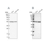 Anti-DARS antibody produced in rabbit Prestige Antibodies&#174; Powered by Atlas Antibodies, affinity isolated antibody, buffered aqueous glycerol solution, ab1