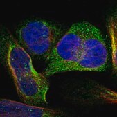 Anti-LSMEM1 antibody produced in rabbit Prestige Antibodies® Powered by Atlas Antibodies, affinity isolated antibody, buffered aqueous glycerol solution