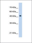 Anti-PNPLA3 antibody produced in rabbit affinity isolated antibody