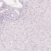 Anti-HOXB13 antibody produced in rabbit Prestige Antibodies&#174; Powered by Atlas Antibodies, affinity isolated antibody, buffered aqueous glycerol solution