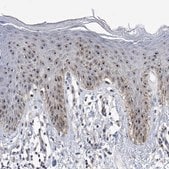 Anti-MPHOSPH10 antibody produced in rabbit Prestige Antibodies&#174; Powered by Atlas Antibodies, affinity isolated antibody, buffered aqueous glycerol solution