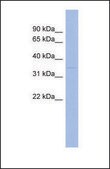 抗-WNT7B 兔抗 affinity isolated antibody