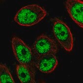 Anti-TRMT44 antibody produced in rabbit Prestige Antibodies® Powered by Atlas Antibodies, affinity isolated antibody, buffered aqueous glycerol solution