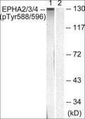 Anti-phospho-EPHA2/3/4 (pTyr588/596) antibody produced in rabbit affinity isolated antibody